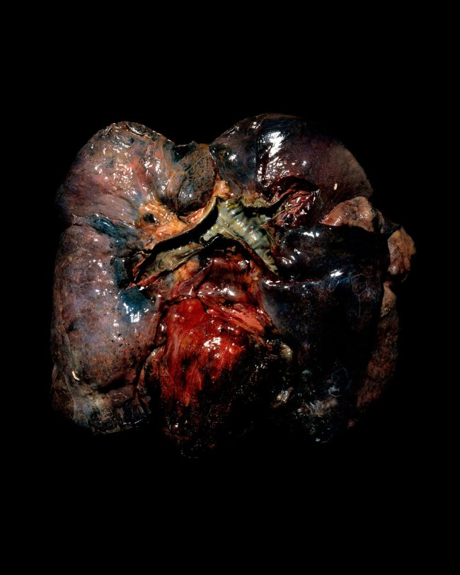 Raphaël Dallaporta (French, b. 1980) 'Fragile, Cardiopulmonary system' 2010