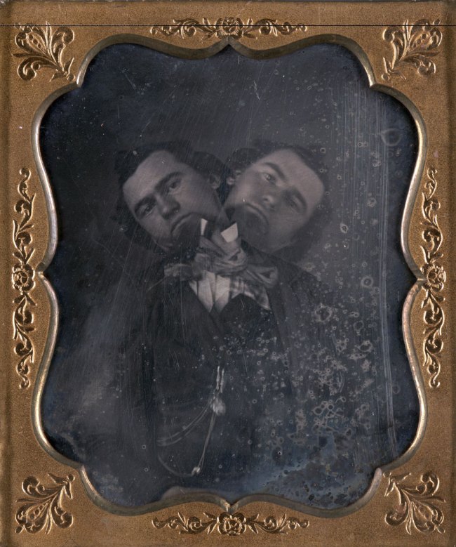 Unidentified American artist. 'Two-Headed Man' c. 1855