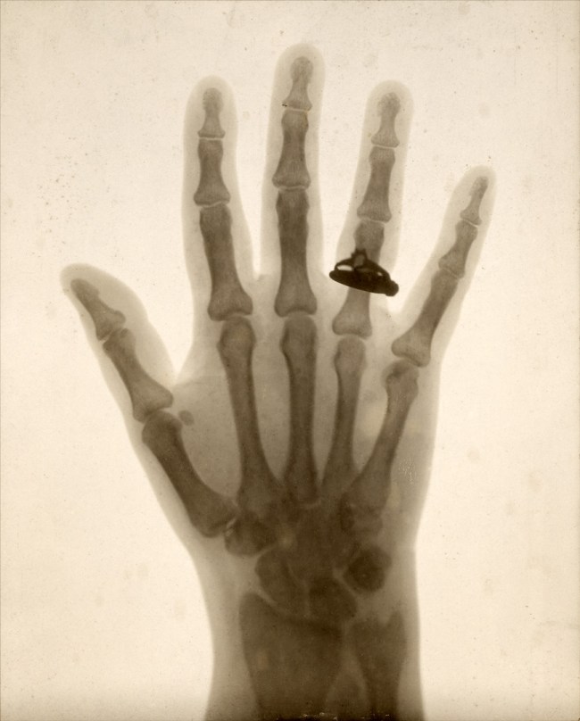 Unknown maker (American) 'Hand X-Ray' 1897