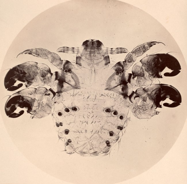 Joseph Javier Woodward (American, 1833-1884) 'Photomicrograph of a Crab Louse' c. 1864-1865