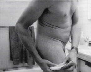 Albert J Winn (American, 1947-2014) 'Drug Related Skin Rashes' 1993