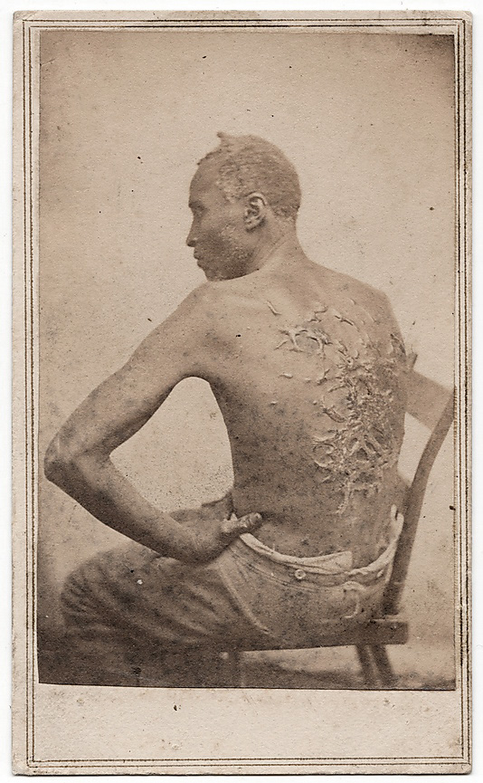 Attributed to McPherson & Oliver (American, active New Orleans and Baton Rouge, Louisiana, 1860s) 'The Scourged Back' April 1863