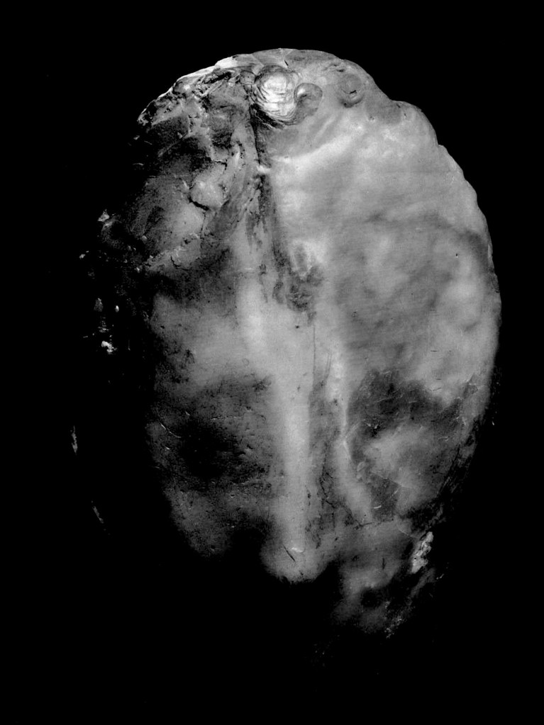 Medardo Rosso (Italian, 1858-1928) 'Madame X' 1896