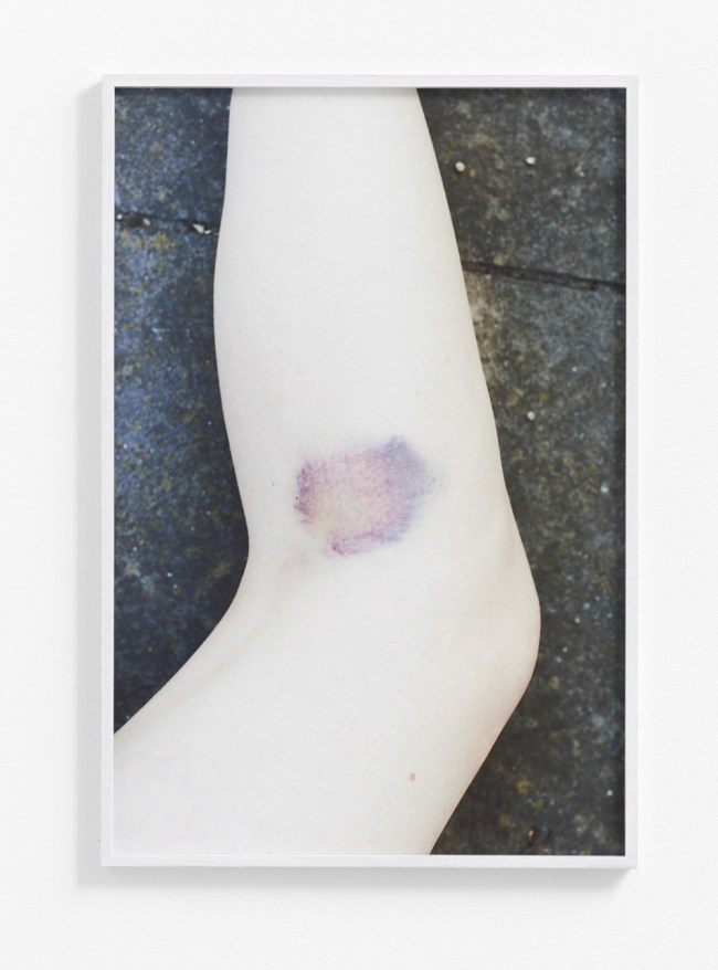 Catherine Evans (Australian) 'Bruise II' 2014