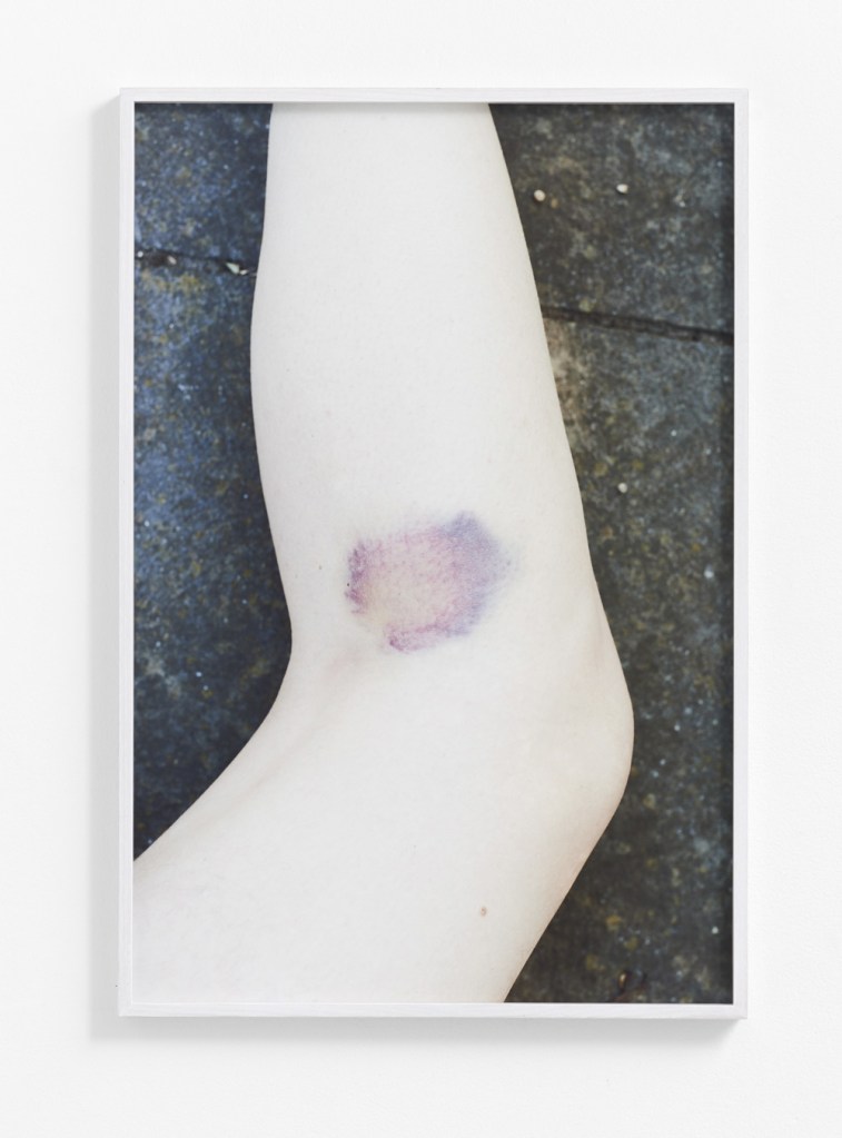 Catherine Evans (Australian) 'Bruise II' 2014