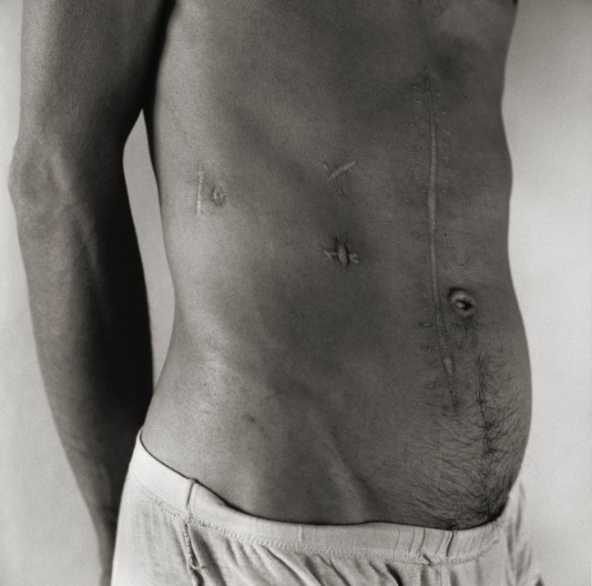 Peter Hujar (American, 1934-1987) 'Pascal (Paris)' 1980