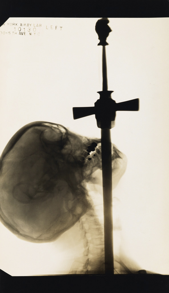 Edward J. Kelty (American, 1888-1967) 'X-ray of Ajax, the sword swallower' 1928