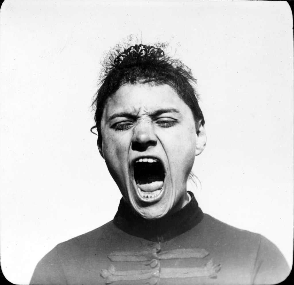 Verm. Albert Londe (French, 1858-1917) 'Hysterics' Nd