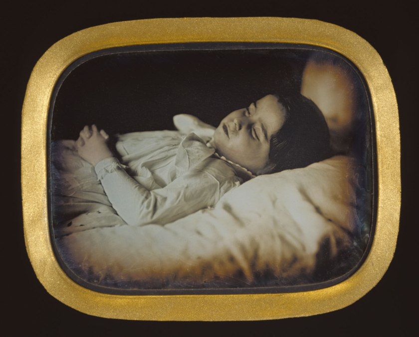 Carl Durheim (Swiss, 1810-1890) 'Postmortem of a Child' c. 1852