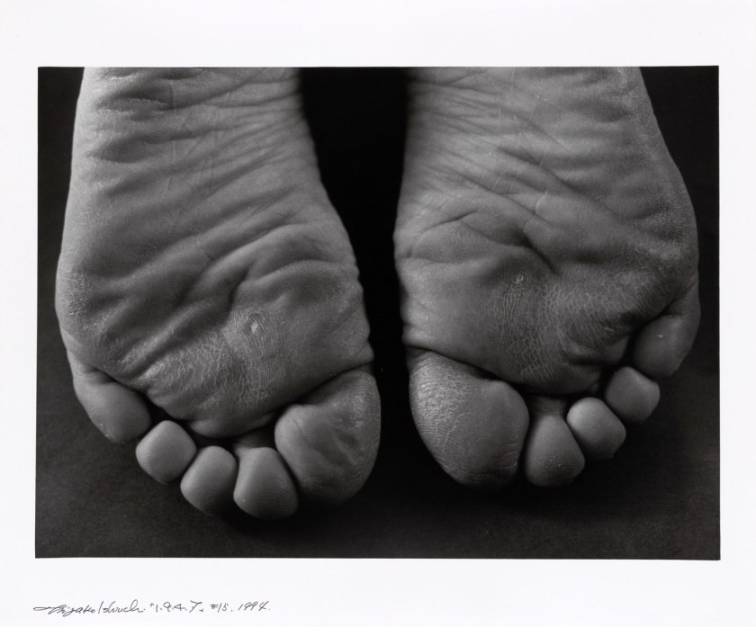 Ishiuchi Miyako (Japanese, b. 1947) '1·9·4·7 #15' negative 1988-1989; print 1994 Ishiuchi Miyako (Japanese, b. 1947) '1·9·4·7 #15' negative 1988-1989; print 1994