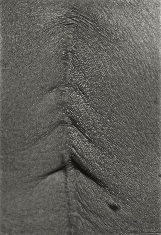 Ishiuchi Miyako (Japanese, b. 1947) 'Scars #45 (Illness 1955)' 2000 Ishiuchi Miyako (Japanese, b. 1947) 'Scars #45 (Illness 1955)' 2000