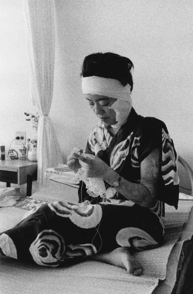 Ken Domon (Japanese, 1909-1990) 'Paziente in ospedale' [Hospital patient] 1957