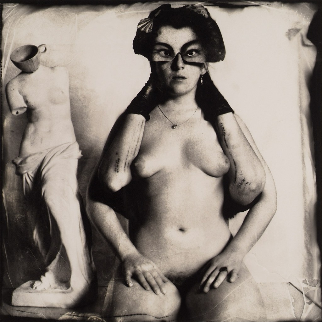 Joel-Peter Witkin (American, 1939-) 'Arms Broken By A Window, New Mexico' 1980 from the exhibition 'Joel-Peter Witkin – Photographs 1980-2016' at William Mora Galleries, Melbourne, August 2017
