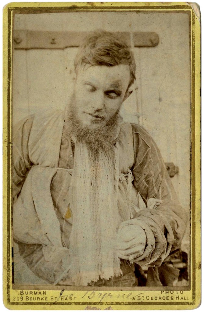 William J. Burman (Australian born England, 1814-1890) 'Joe Byrne's Body, Benalla Gaol, 29 June 1880' 1880 from the exhibition 'An unorthodox flow of images' at the Centre for Contemporary Photography (CCP), Melbourne, Sept - Dec, 2017