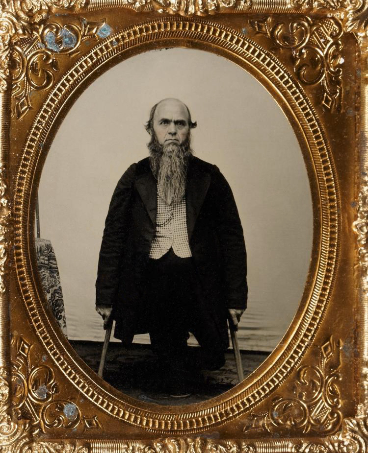 Unknown photographer (American) 'Untitled [Man on crutches]' c. 1850-1860s