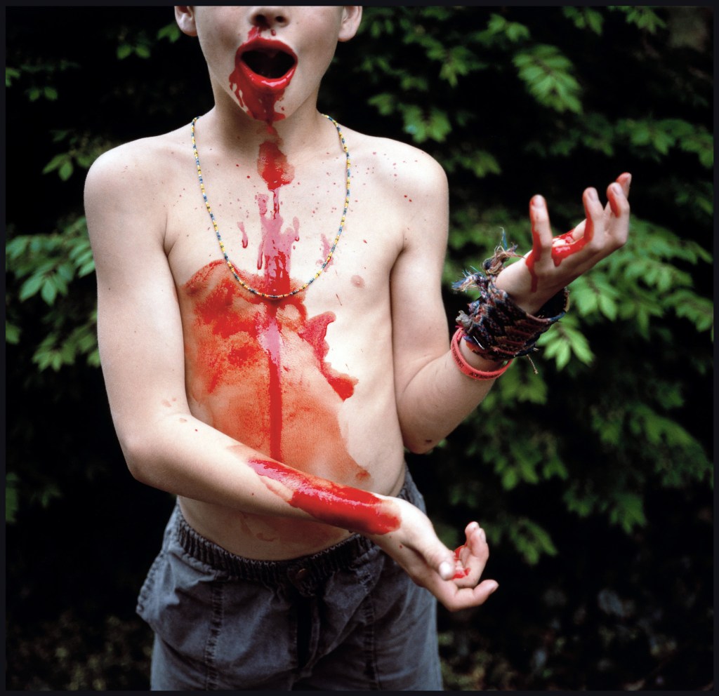 Sally Mann (American, born 1951) 'Bloody Nose' 1991