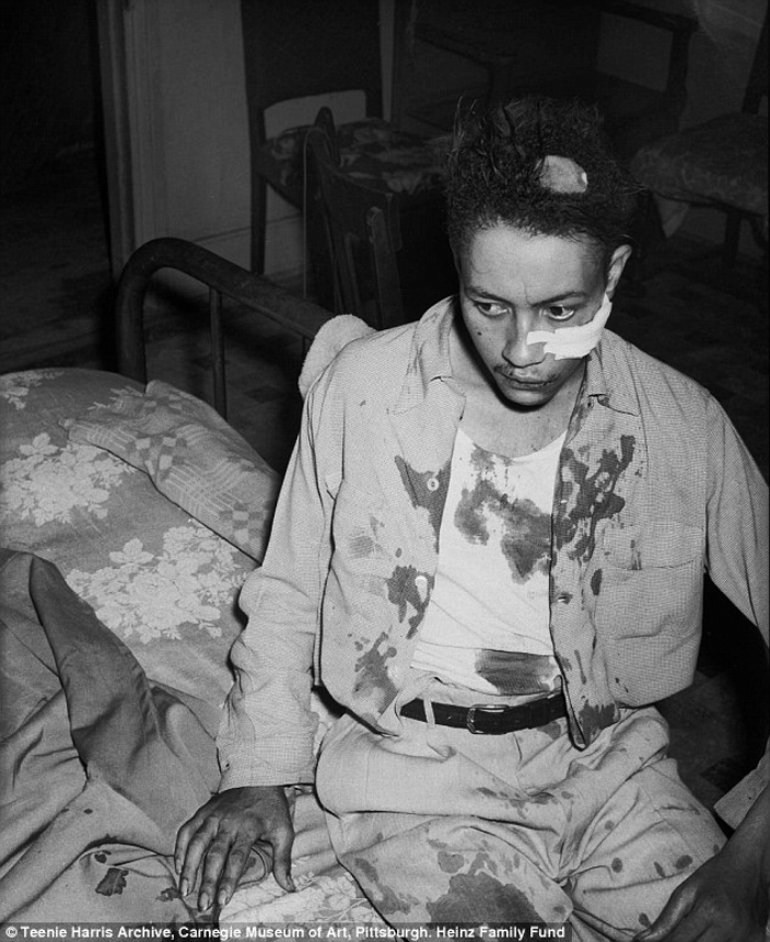Charles "Teenie" Harris (American, 1908-1998) 'John Davis after being beaten by police officer Dan McTague, in his home at 1303 Wylie Avenue, Hill District, August 1951' 1951 from the exhibition 'African American Portraits: Photographs from the 1940s and 1950s' at the Metropolitan Museum of Art, New York, June - Oct, 2018