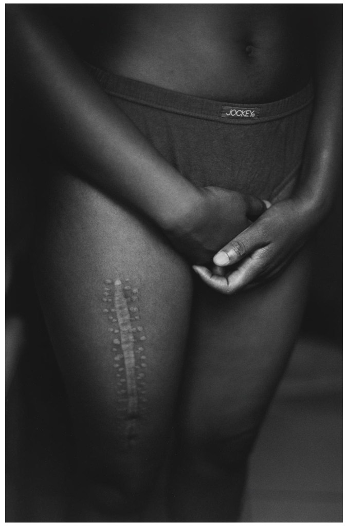 Zanele Muholi. 'Aftermath' 2004