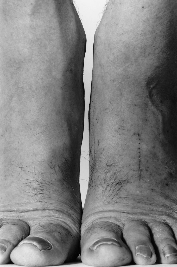 John Coplans (British, 1920-2003) 'Feet, Frontal' 1984