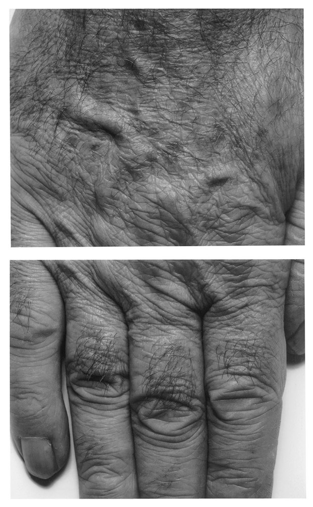 John Coplans (British, 1920-2003) 'Hand, Two Panels, Vertical' 1988