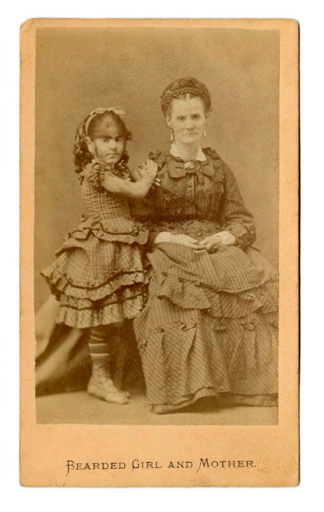Unknown photographer (American). "Bearded Girl and her Mother" c. 1880s