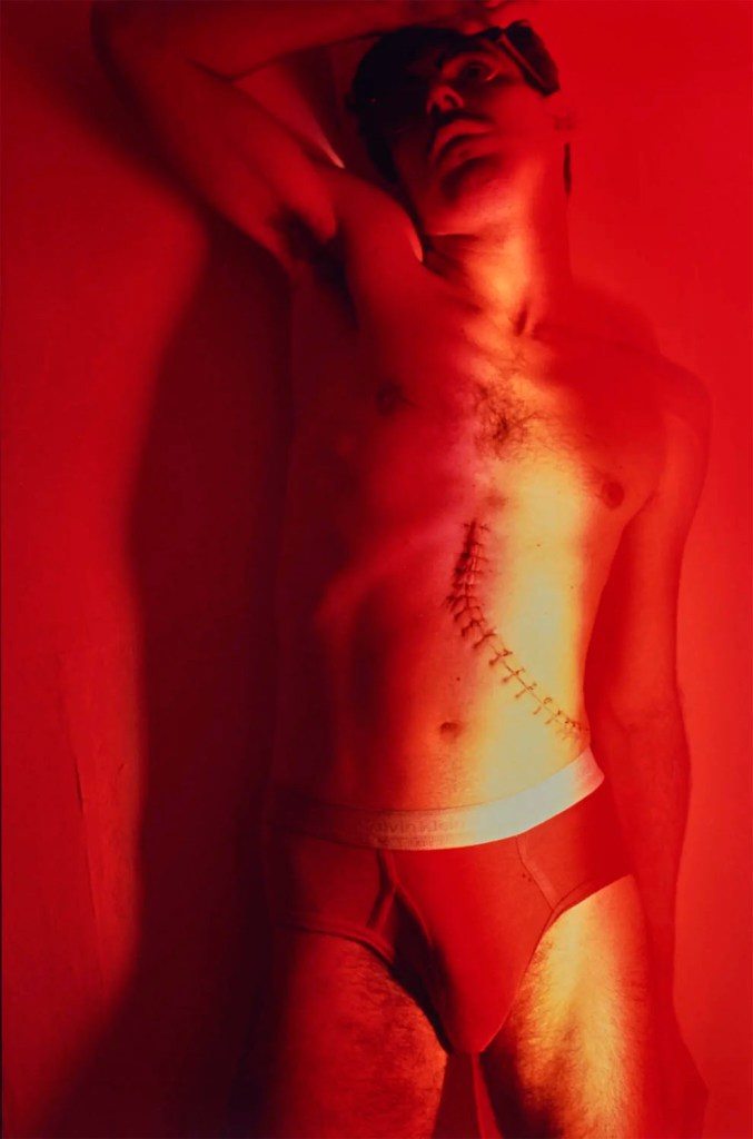 Jimmy DeSana (American, 1949-1990) 'Stitches' 1984