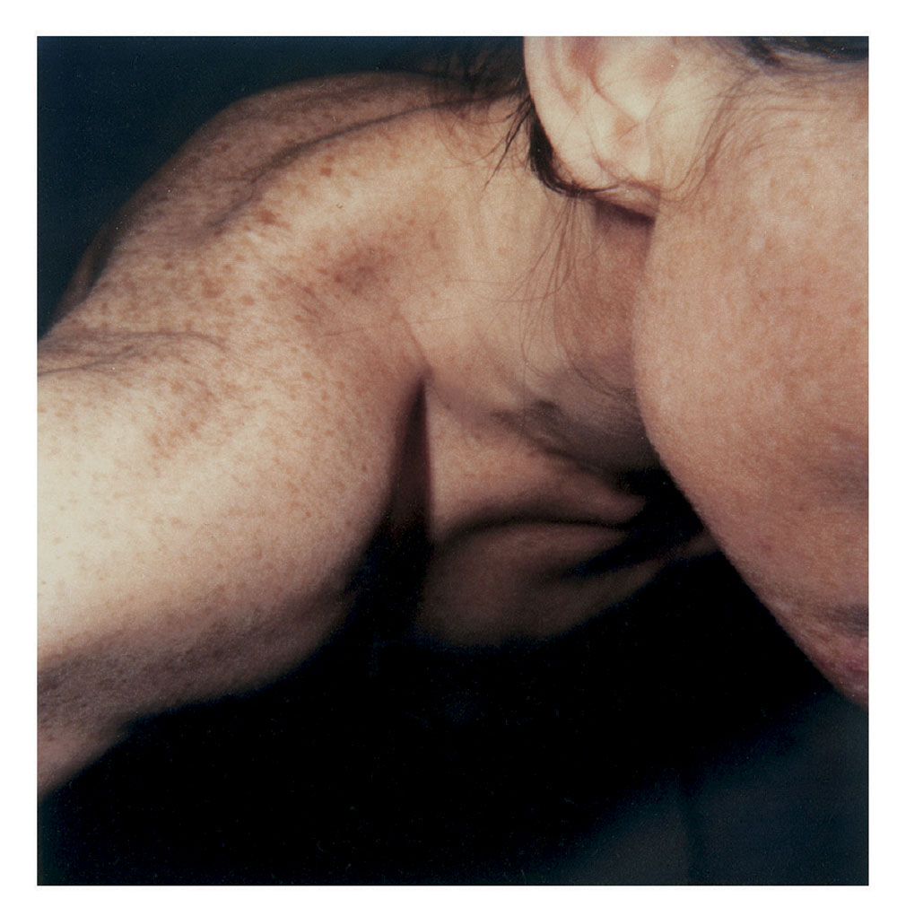 Hannah Villiger (Swiss, 1951-1997) 'Block XIII' 1989 (detail)