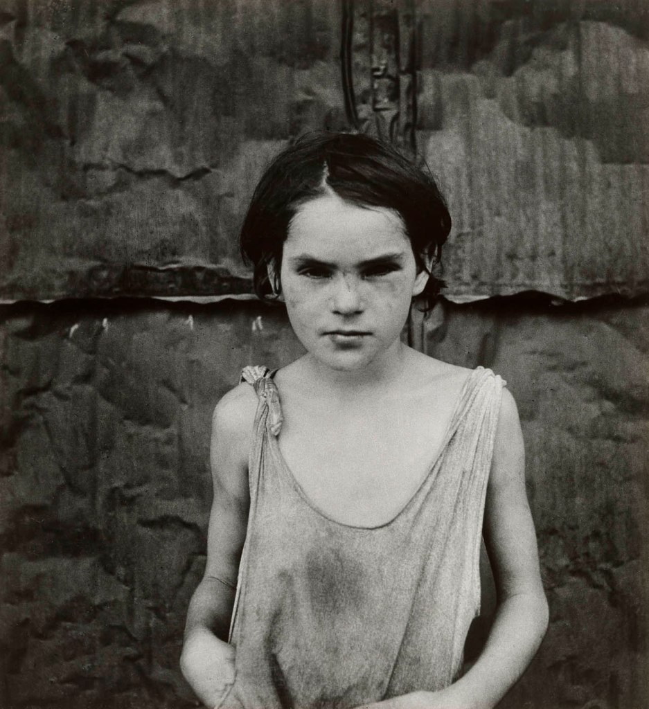 Dorothea Lange (American, 1895-1965) 'Child Living in Oklahoma City Shacktown [Damaged Child, Shacktown]' August 1936