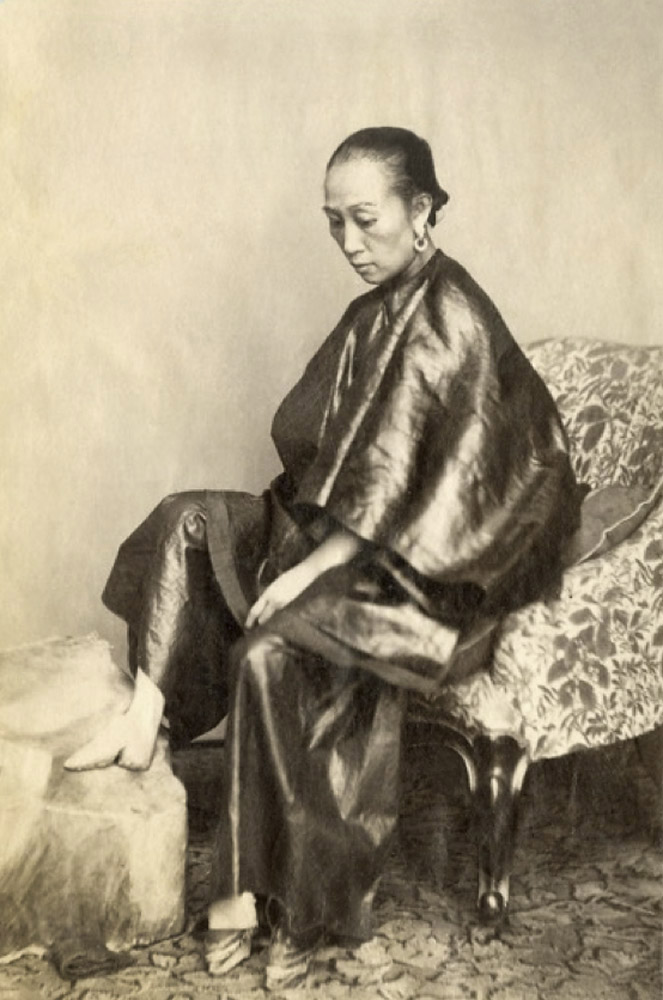 Lai Fong (Chinese, c. 1839-1890), Afong Studios. 'Bound Foot Exposed' [A Chinese Golden Lily Foot] 1870s