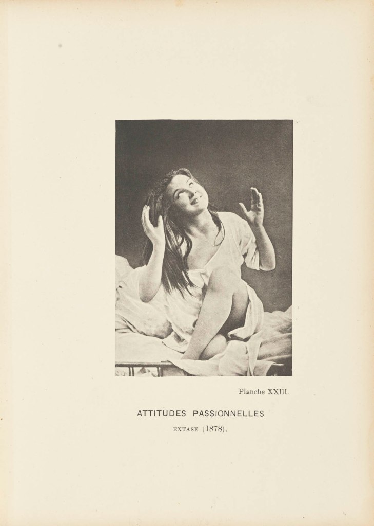 Paul-Marie-Léon Regnard (French, 1850-1927) 'Passionate Ecstatic Position/Expression' 1878 Part of 'Iconographie Photographique de la Salpetriere' (Service de M. Charcot)